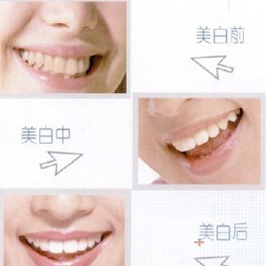 圣贝 重建微笑与自信