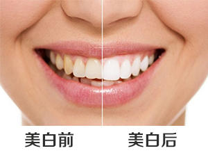 美白后能持续多久？
