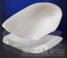 补牙的方法有哪些