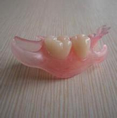 种植牙优点