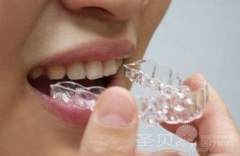 矫正牙齿稀疏