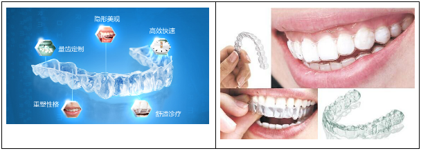 牙齿矫正哪种方法好